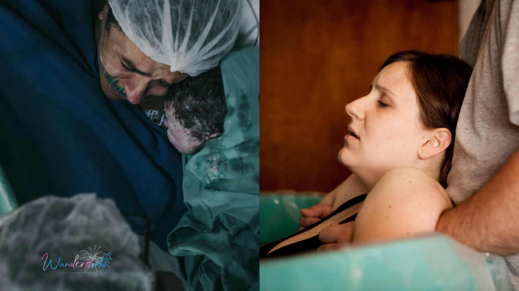 An overview of different birth settings, including home and hospital births.